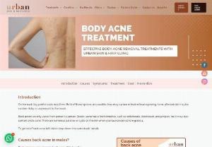 Body Acne Treatment  in India | USHC - Get rid of painful body acne today with best body acne treatment Centre in India. Get customize treatment plan at an affordable price.