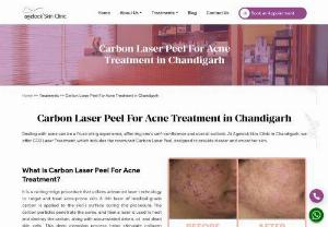 Laser Treatment in Chandigarh | Fractional CO2 Laser Skin Resurfacing - At Agelock Skin Clinic, our dermatologists are dedicated to offering effective treatments customized to your specific requirements. You can rely on us to handle your skin issues with skill and compassion.
