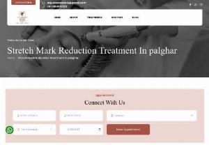 Stretch Mark Reduction Treatment In Palghar - Say goodbye to stretch marks with the best reduction treatment in Palghar. Restore skin confidence and achieve smoother, even-toned skin with our advanced solutions.