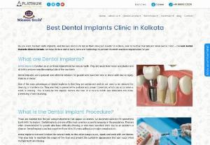 Best Dental Implants Clinic In Kolkata - Mission Smile - Looking for a single-tooth dental implant clinic or advanced dental implant surgery in Kolkata? Visit our top-rated clinic for best treatment.