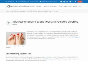 Addressing Longer Second Toes with Podiatric Expertise - In this article, we’ll explore the potential causes of a Morton’s toe, its impact, and how your Houston podiatrist can help address this concern through an in-office procedure.