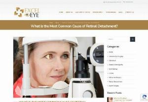 What is the Most Common Cause of Retinal Detachment? - Retinal detachment is a serious eye condition that occurs when the retina, the light-sensitive tissue at the back of the eye, is pulled away from its normal position. Retinal detachment causes a separation between the retinal cells and the layer of blood vessels responsible for supplying oxygen and nutrients to the eye. If left untreated for an extended period, the chances of experiencing permanent vision loss in the affected eye significantly increase.