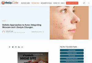 Holistic Approaches to Acne: Integrating Skincare and Lifestyle Changes - Acne, a common skin condition that affects millions of individuals worldwide, can be both frustrating and challenging to manage. While professional acne treatment in Chennai and skincare products play a vital role in acne management, adopting a holistic approach that includes lifestyle changes, stress management, and proper nutrition can significantly complement your efforts.