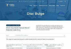Disc Bulge Treatment in Pune - Imagine a gel-like cushion between your vertebrae, absorbing shocks and supporting your spine. Now, picture that cushion losing shape and position, resulting in a disc bulge.