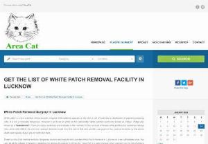 White Patch Removal  Facility  In  Lucknow - 
