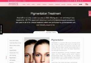 Advanced Pigmentation treatment at Anoos - Transform your skin with Anoos' specialized pigmentation treatment, designed to restore your natural radiance. Our skilled experts provide personalized solutions for various pigmentation concerns, using advanced technologies and premium products to deliver effective and lasting results.
