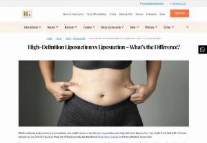 High-Definition Liposuction vs Liposuction &ndash; What&rsquo;s the Difference? - While exploring body contouring procedures, you might come across the term liposuction and high-definition liposuction. You might think that both of these procedures are similar. However, there are differences between traditional liposuction surgery and high-definition liposuction.