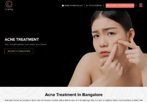 Acne Treatment in Bangalore - Acne is one of the most common skin concerns. It makes the face unpleasant and demotivates one in front of friends and colleagues. Fortunately, these painful bumps are reversible and to correct them one can get effective treatment at Charma Clinic. This clinic was founded by Dr. Rajdeep Mysore who is renowned for the Best Acne Treatment In Bangalore.