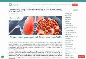 Causes of Community Acquired Pneumonia - Community-acquired pneumonia, abbreviated as CAP, is a respiratory infection that occurs outside the walls of healthcare facilities, distinguishing it from hospital-acquired pneumonia. This ailment does not discriminate based on age, affecting individuals of all demographics. It can range from mild to severe, and in some instances, it may necessitate hospitalization.  Early diagnosis and appropriate treatment are key to managing Community-acquired pneumonia effectively.