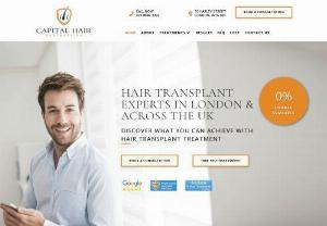 hair transplant London - Hair transplant surgery for men and women. Professional hair restoration and FUE Hair transplant - FUT Hair transplant treatments in London and the UK.