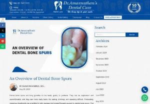 An Overview of Dental Bone Spurs - The dental bone spurs make humans uncomfortable in their routine. If you need to know more about this, just keep reading.