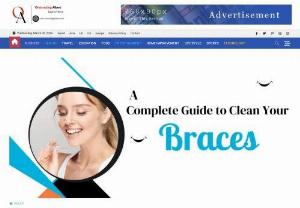 A Complete Guide to Clean Your Braces - Adhering to all of these steps or tips will contribute to the progress of the treatment in a positive manner. However, when you need Clear Fixed Braces Cost UK for correcting teeth alignment problem you should always consult with a dentist beforehand. Chatfield Dental Braces, Invisalign London can be your reliable destination to get your teeth straightened at competitive costs. Book an appointment and let the experienced dentist perform the treatment.