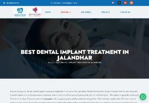 dental implant - Dental treatment encompasses a wide range of procedures aimed at maintaining oral health, treating dental issues, and improving the appearance of teeth and gums.
