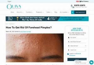 How To Get Rid Of Forehead Pimples? - Forehead pimples can be annoying and can affect anyone, regardless of age. They are typically caused by a combination of factors, such as oil production, dead skin cells, clogged pores, and bacteria.