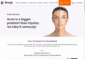 Acne Treatment in Ahmedabad | Sparsh Skin Clinic - Struggling with acne? Look no further! Sparsh Skin Clinic offers expert acne treatment in CTM, Ahmedabad. Our dermatologist specializes in addressing acne concerns effectively. Say goodbye to breakouts and hello to clear, radiant skin. Book your appointment today and start your journey towards a flawless complexion.