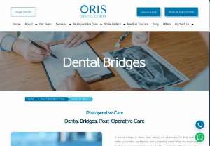 Dental Bridges: Postoperative Care - Have you recently had your dental Bridges., But worrying about PostOperative Care. Read these guidelines.