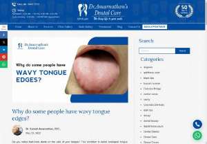 Scalloped Tongue | Crenated Tongue - Having indentations, notches, or ridges around the tongue edges is not just an oral concern. It is interrelated to many medical conditions as listed here.