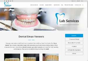 Emax Porcelain Veneers from Midway Dental Laboratory: The Best You Can Get - Dental clinics rely on dental labs when it comes to creating Emax porcelain veneers. These dental labs use digital solutions that improve accuracy. Midway Dental Laboratory is a dental lab that has served dentists and dental clinics. You can rely on this lab as well. It will make sure to deliver the right services.