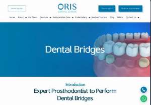 Prosthodontist in Dubai | Dental Bridges in Dubai - We are experts in Dental care. Our team of  qualified dentists and best Prosthodontist in Dubai UAE,. provide the best fixable &amp; removable prosthodontics.