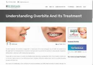 Overbite Correction In India - Discover effective overbite correction solutions in India at Dr. Motiwala&#039;s clinic, where advanced techniques meet affordability. An overbite occurs when the upper front teeth overlap significantly with the lower front teeth, affecting both aesthetics and functionality. Dr. Motiwala&#039;s clinic specializes in correcting overbites using cutting-edge orthodontic treatments tailored to each patient&#039;s needs. With skilled orthodontists and state-of-the-art technology,...