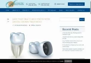 Screenshot of Dental Crown Treatment in Jackson, NJ