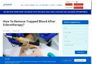 Screenshot of How to Remove Trapped Blood After Sclerotherapy