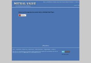 Mitral Valve 	 - The ValvesofHeart is an educational website designed to provide readers with a comprehensive view of valvular heart disease with both historical and contemporary approaches. The first edition primarily focuses on the mitral valve and is entitled TheMitralValve