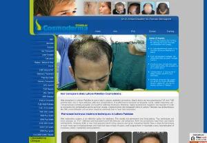 Hair transplant cost in Pakistan - Hair transplant FUE in Pakistan Lahore by no touch and without incision and stitches technique Get 4000 5000 fue follicles in single session by Dr Ahmad to treat hair loss and baldness.
